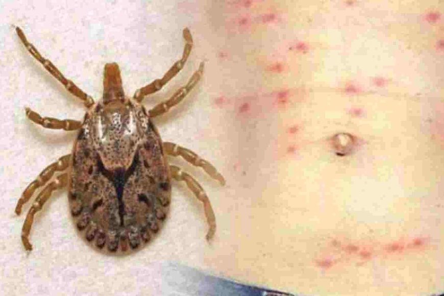 ସୁନ୍ଦରଗଡ଼ରେ ଚିହ୍ନଟ ୬ଜଣ ନୂଆ ସ୍କ୍ରବ୍ ଟାଇଫସ୍‌ ରୋଗୀ : ସଂଖ୍ୟା ୨୦୬କୁ ବୃଦ୍ଧି