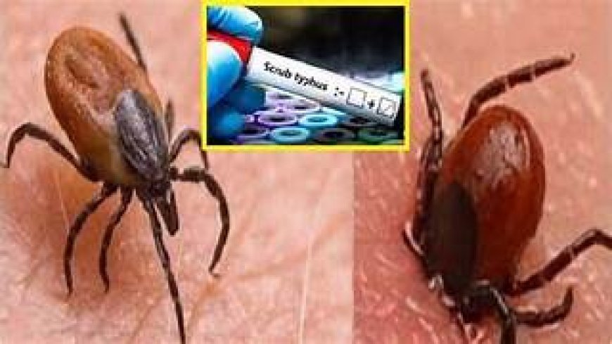 ସ୍କ୍ରବ୍‌ ଟାଇଫସ: ସୁନ୍ଦରଗଡ଼ରେ ଆଉ ୯ ପଜିଟିଭ ଚିହ୍ନଟ୍