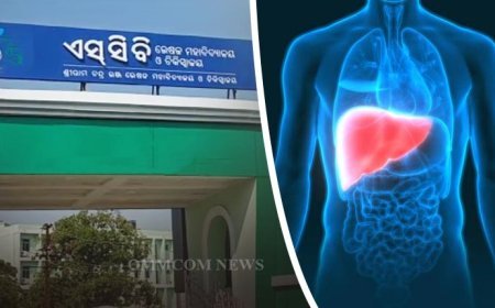 ଏସ୍‌ସିବିରେ ପ୍ରଥମ ଲିଭର ଟ୍ରାନ୍‌ସପ୍ଲାଣ୍ଟ୍‌